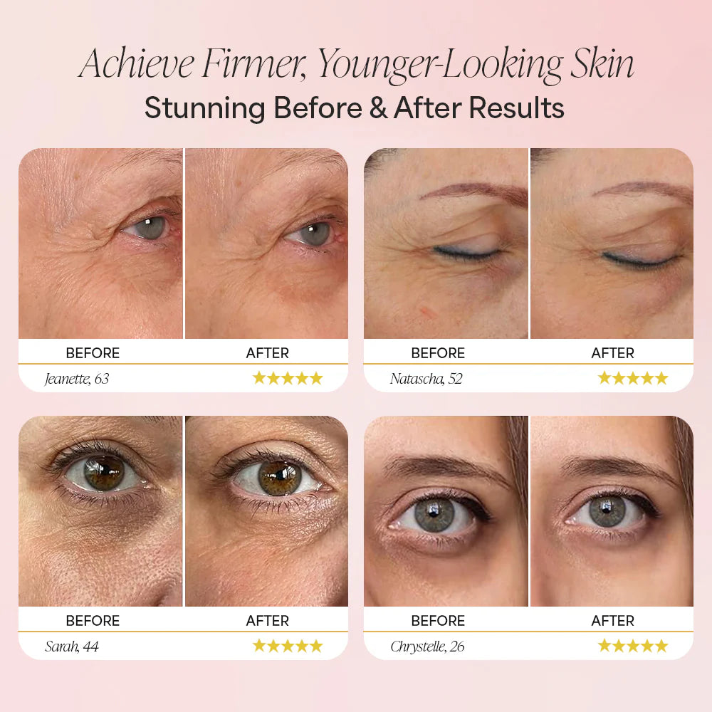 VTLFX Eye Cream + Free Neck Roller
