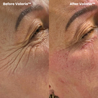 Voloria PDRN & Collagen Eye Patches