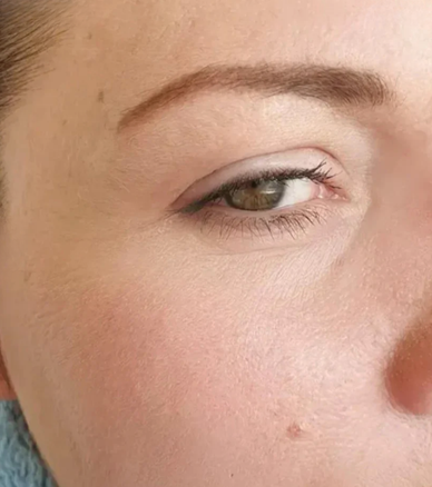 Återfå din lyster och känn dig yngre!